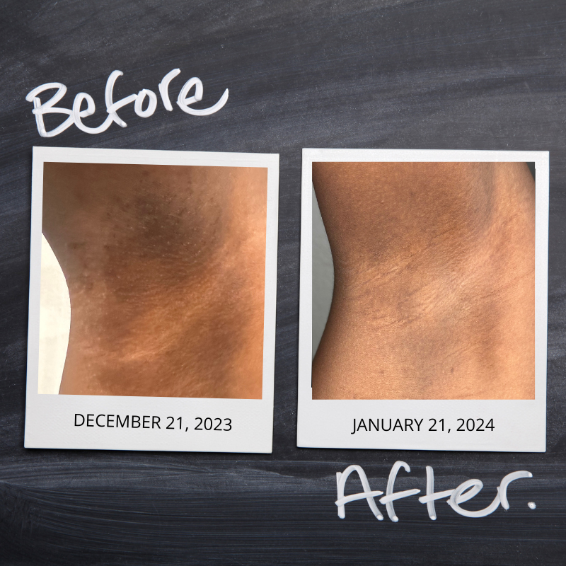 Orange Turmeric Bar (Face & Body)